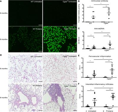 cGAS deficiency enhances inflammasome activation in macrophages and inflammatory pathology in pristane-induced lupus